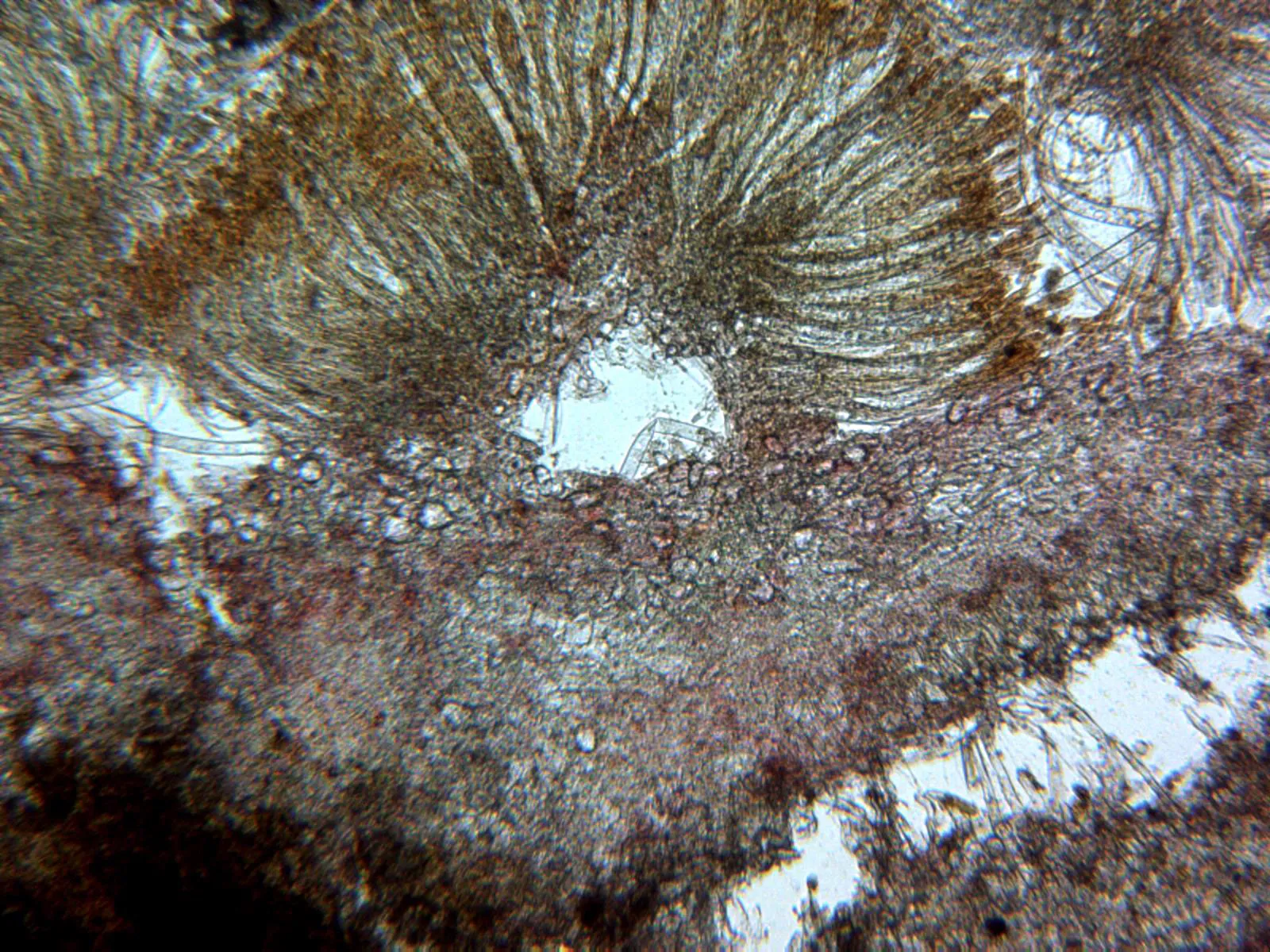 Microscopía de Miladina lecithina - 11 - Sección x 100